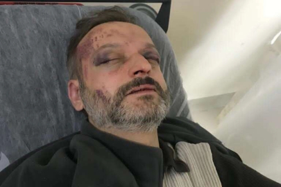 Çiftetelli çalmadı diye öldüresiye dövdüler