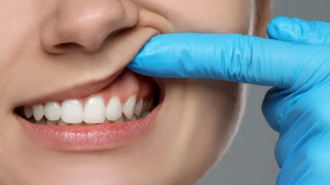 Diş eti çekiliyorsa kemik de eriyordur!