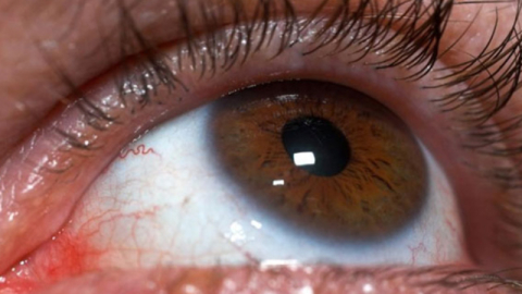 Göz sağlığı öğrencinin başarısına etki ediyor