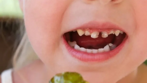 Okul çağındaki çocuklarda çürük riskine dikkat edilmeli