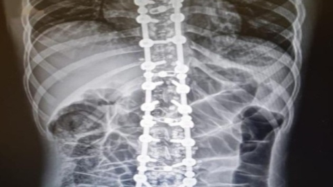 Omurganız yılların altında ezilmesin!