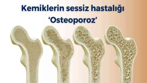 "Kemik erimesi ölüme yol açabilir"