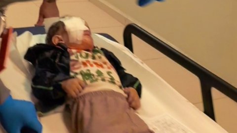 Torpil faciasında 2 yaşındaki çocuk ağır yaralandı