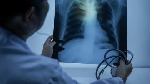 Zatürre toplum sağlığı için büyük tehdit