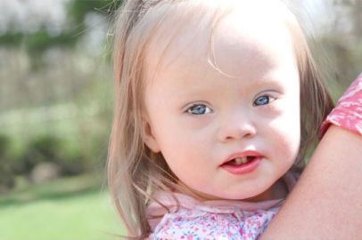 Down sendromu hakkında bilinmesi gerekenler