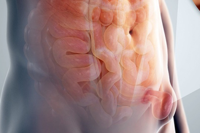 Yatınca kaybolan o şişliğe dikkat