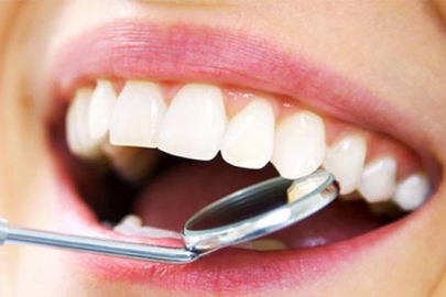 "Mutlu Bir Ağız, Mutlu Bir Hayat Demektir"