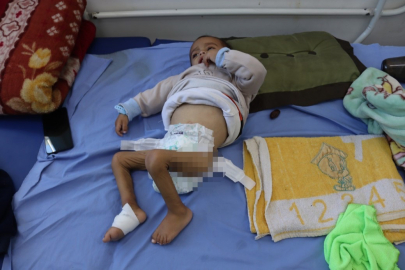 Gazzeli çocuklar ateşkesin gölgesinde açlıkla savaşıyor