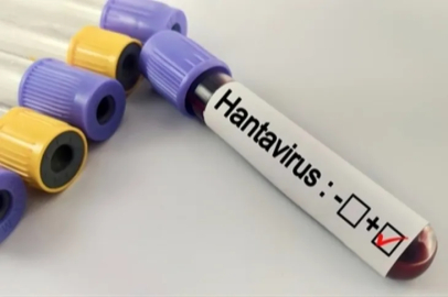 Hantavirüs salgına dönüşür mü?