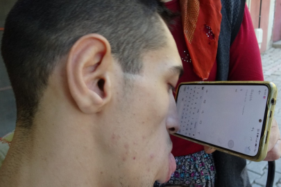 Engelleri burnuyla aştı: Telefonuyla hayata tutundu