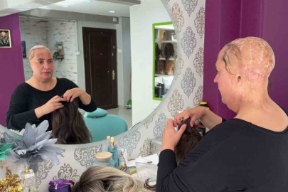 12 yaşında saçlarını ve kulaklarını kaybetti, şimdi kadınlara umut oluyor