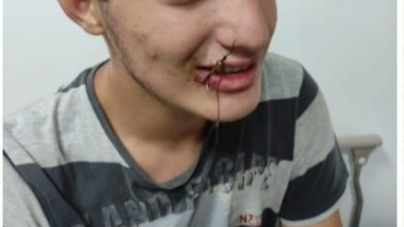 Bu kez oltaya çocuk takıldı