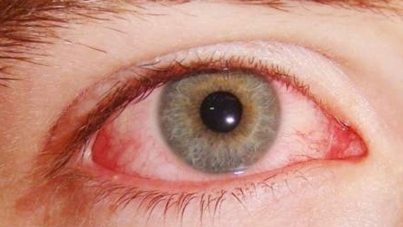 Retina ve vitreus hastalıklarına dikkat edilmeli