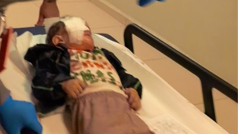 Torpil faciasında 2 yaşındaki çocuk ağır yaralandı